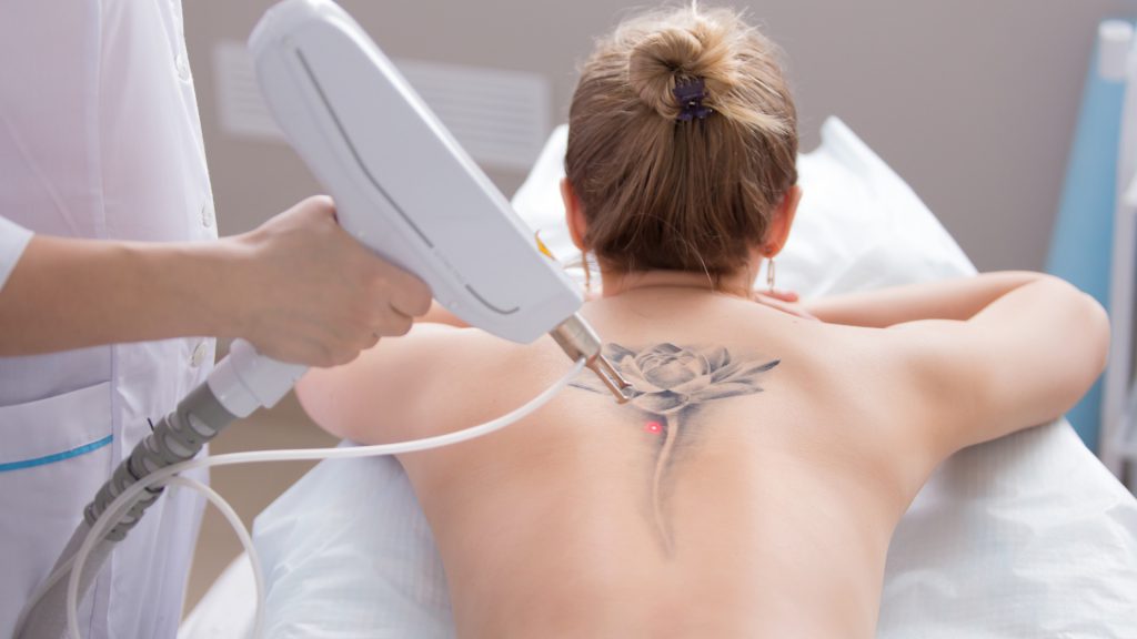 ‘Know your math about Skin Tats : A map to navigate the nuances of Laser Tattoo Removal
