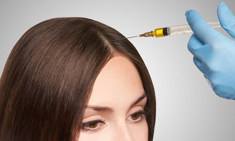 PRP hair loss injections: