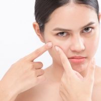 11 Dermatological Concerns